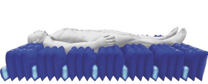 Quattro Acute Wechseldrucksystem